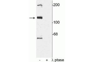 Western blot of rat cortical lysate showing specific immunolabeling of the ~120 kDa TAO2 phosphorylated at Ser181 in the first lane (-).