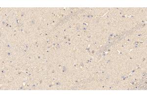 Immunohistochemistry (IHC) image for anti-Superoxide Dismutase 1, Soluble (SOD1) (AA 2-153) antibody (ABIN7443155)
