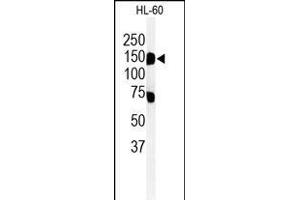 Western blot analysis of T131L Antibody (C-term) (ABIN651155 and ABIN2840102) in HL-60 cell line lysates (35 μg/lane). (TMEM131L 抗体  (C-Term))