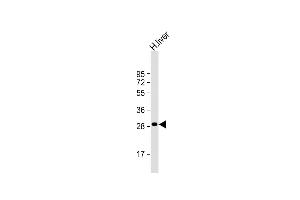 Anti-QDPR Antibody (C-term) at 1:1000 dilution + human liver lysate Lysates/proteins at 20 μg per lane.