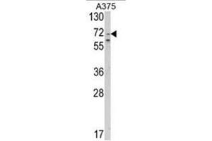 Western blot analysis of SLC23A2 Antibody (N-term) in A375 cell line lysates (35ug/lane). (SLC23A2 抗体  (N-Term))