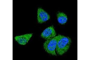Confocal immunofluorescent analysis of C6 antibody with MDA-MB231 cells followed by Alexa Fluor 488-conjugated goat anti-rabbit lgG (green). (C6 抗体  (AA 30-58))