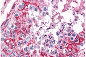 Human Testis: Formalin-Fixed, Paraffin-Embedded (FFPE)