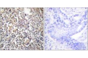 Immunohistochemistry analysis of paraffin-embedded human thyroid gland tissue, using Fibronectin 1 Antibody. (Fibronectin 1 抗体  (AA 2337-2386))