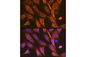Immunofluorescence analysis of NIH-3T3 cells using PEN2/PSENEN Rabbit mAb (ABIN7269513) at dilution of 1:100 (40x lens). (PEN2 抗体)