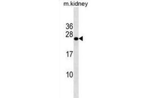 Western Blotting (WB) image for anti-GrpE-Like 2, Mitochondrial (GRPEL2) antibody (ABIN3000757) (GRPEL2 抗体)