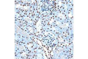 Immunohistochemistry of paraffin-embedded mouse kidney using Histone H2B Rabbit mAb (ABIN7267736) at dilution of 1:100 (40x lens). (HIST1H2BK 抗体)