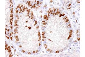 Immunohistochemistry (IHC) image for anti-Minichromosome Maintenance Complex Component 2 (MCM2) (AA 1-50) antibody (ABIN7448987)