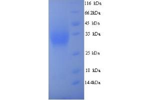 SDS-PAGE (SDS) image for Meteorin, Glial Cell Differentiation Regulator-Like (METRNL) (AA 46-311) protein (His tag) (ABIN5714378) (METRNL Protein (AA 46-311) (His tag))