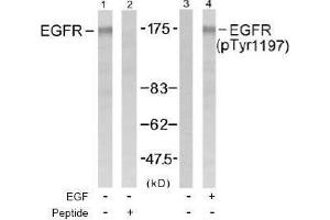 Image no. 1 for anti-Epidermal Growth Factor Receptor (EGFR) (pTyr1197) antibody (ABIN196974) (EGFR 抗体  (pTyr1197))