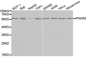 Western blot analysis of extracts of various cell lines, using IFNAR2 antibody (ABIN5970890) at 1/1000 dilution. (IFNAR2 抗体)