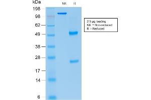 SDS-PAGE Analysis Purified p21 Mouse Recombinant Monoclonal Antibody (rCIP1/823). (Recombinant p21 抗体)