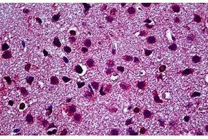Mouse Brain: Formalin-Fixed, Paraffin-Embedded (FFPE) (TLR9 抗体  (N-Term))
