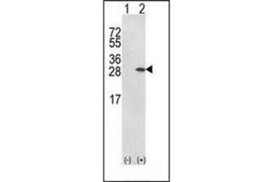 Western Blotting (WB) image for anti-Glutathione S-Transferase pi 1 (GSTP1) (AA 171-201), (C-Term) antibody (ABIN453076)