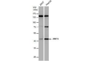 WB Image WNT4 antibody detects WNT4 protein by western blot analysis. (WNT4 抗体  (Center))