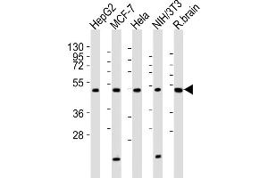 All lanes : Anti-P2R2A Antibody (N-term) at 1:2000 dilution Lane 1: HepG2 whole cell lysates Lane 2: MCF-7 whole cell lysates Lane 3: Hela whole cell lysates Lane 4: NIH/3T3 whole cell lysates Lane 5: rat brain lysates Lysates/proteins at 20 μg per lane.
