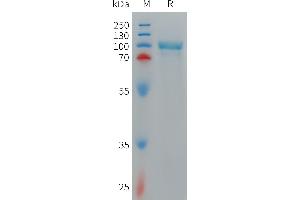 SDS-PAGE (SDS) image for CD93 (CD93) (AA 24-581) protein (His tag) (ABIN7538176)