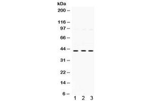 Western blot testing of 1) rat kidney, 2) human HeLa, and 3) human A549 lysate with SAPK4 antibody. (MAPK13 抗体)
