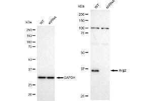 Western blotting analysis using Arg2 antibody (ABIN7797644). (Recombinant ARG2 抗体)