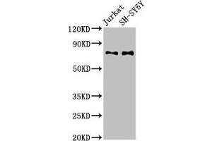 Western Blot Positive WB detected in: Jurkat whole cell lysate, SH-SY5Y whole cell lysate All lanes: RAVER2 antibody at 3 μg/mL Secondary Goat polyclonal to rabbit IgG at 1/50000 dilution Predicted band size: 75, 73 kDa Observed band size: 75 kDa