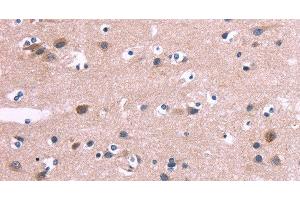 Immunohistochemistry of paraffin-embedded Human brain tissue using DUSP13 Polyclonal Antibody at dilution 1:60 (DUSP13 抗体)