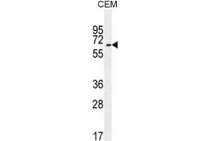 Western Blotting (WB) image for anti-UNC Homeobox (UNCX) antibody (ABIN2996063) (UNCX 抗体)