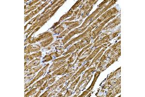 Immunohistochemistry of paraffin-embedded mouse heart using BNP Rabbit pAb (ABIN3023135, ABIN3023136, ABIN3023137, ABIN1513273 and ABIN6219406) at dilution of 1:200 (40x lens). (NPPB 抗体  (AA 1-134))
