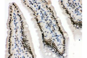 Anti- HMG4 Picoband antibody, IHC(P) IHC(P): Mouse Intestine Tissue (HMGB3 抗体  (N-Term))
