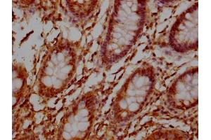 Immunohistochemistry (IHC) image for anti-Tumor Necrosis Factor Receptor Superfamily, Member 17 (TNFRSF17) (AA 1-54) antibody (ABIN7172255)