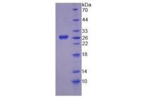 SDS-PAGE analysis of Human HGD Protein. (HGD 蛋白)