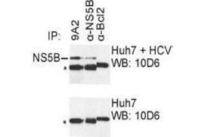 Western Blotting (WB) image for anti-Hepatitis C Virus NS5 (HCV NS5) (AA 111-130) antibody (ABIN781784) (HCV NS5 抗体  (AA 111-130))