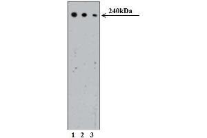 Western blot analysis of CRIK on Human Jurkat cell lysate (ATCC TIB-152). (CIT 抗体  (AA 1420-1612))
