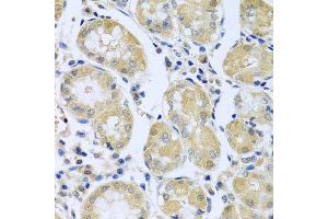 Immunohistochemistry of paraffin-embedded human stomach using FBXL5 antibody at dilution of 1:100 (x40 lens). (FBXL5 抗体)