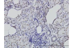 Immunoperoxidase of monoclonal antibody to CDC25C on formalin-fixed paraffin-embedded human salivary gland. (CDC25C 抗体  (AA 21-130))