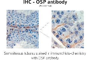 Image no. 1 for anti-Claudin 11 (CLDN11) (C-Term) antibody (ABIN346949) (Claudin 11 抗体  (C-Term))