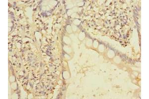 Immunohistochemistry of paraffin-embedded human small intestine tissue using ABIN7166436 at dilution of 1:100 (EEF2KMT (AA 1-330) 抗体)
