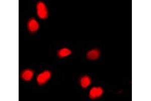 Immunofluorescent analysis of Histone H3 (pT11) staining in HepG2 cells.