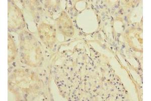 Immunohistochemistry of paraffin-embedded human kidney tissue using ABIN7170191 at dilution of 1:100 (SLC25A36 抗体  (AA 58-110))