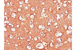 Immunohistochemistry of paraffin-embedded human brain tissue using ABIN7143307 at dilution of 1:100 (Adenosine A2b Receptor 抗体  (AA 292-332))