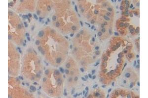 Detection of CACYBP in Human Kidney Tissue using Polyclonal Antibody to Calcyclin Binding Protein (CACYBP)