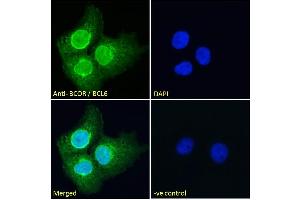 ABIN185043 Immunofluorescence analysis of paraformaldehyde fixed A431 cells, permeabilized with 0.