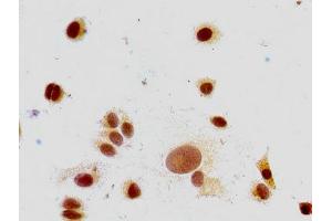 Immunocytochemistry analysis of MCF-7 cells using ABIN7139591 at dilution of 1:100 (HIST1H1E 抗体  (meLys147))