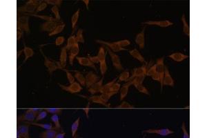 Immunofluorescence analysis of HeLa cells using UBE2L3 Polyclonal Antibody at dilution of 1:100 (40x lens). (UBE2L3 抗体)