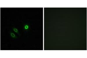 Immunofluorescence analysis of A549 cells, using OR4X1 Antibody. (OR4X1 抗体  (AA 256-305))