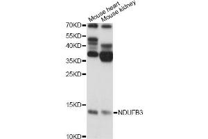 Western blot analysis of extracts of various cell lines, using NDUFB3 antibody. (NDUFB3 抗体)