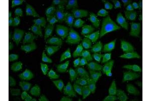 Immunofluorescence staining of Hela cells with ABIN7160104 at 1:133, counter-stained with DAPI. (MKL1 抗体  (AA 674-812))