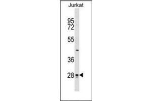 Western blot analysis of CTDSP1 Antibody (N-term) in Jurkat cell line lysates (35ug/lane). (CTDSP1 抗体  (N-Term))