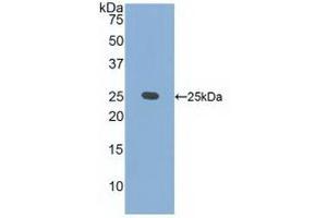 Detection of Recombinant CRADD, Human using Polyclonal Antibody to CASP2 And RIPK1 Domain Containing Adaptor With Death Domain Protein (CRADD) (CRADD 抗体  (AA 1-199))