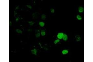 Anti-DNTTIP1 mouse monoclonal antibody (ABIN2452956) immunofluorescent staining of COS7 cells transiently transfected by pCMV6-ENTRY DNTTIP1 (RC206867). (DNTTIP1 抗体)