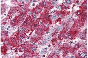 Immunohistochemistry (Formalin-fixed Paraffin-embedded Sections) (IHC (fp)) image for anti-Proprotein Convertase Subtilisin/kexin Type 6 (PCSK6) (Internal Region) antibody (ABIN461695)